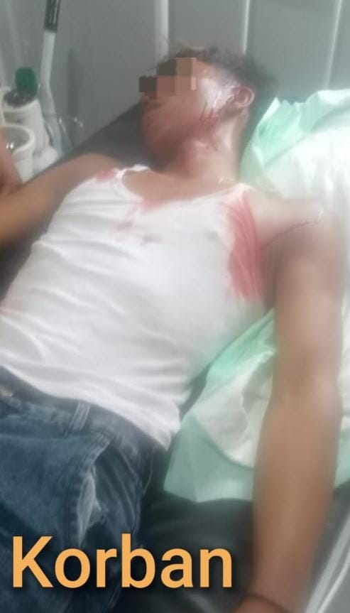 Saat Berada di Dermaga Dishub Desa Sungsang III, Tiba – Tiba Rio Pratama Dikeroyok Oleh Orang Yang Tak DiKenal