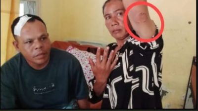 Sekian Bulan Pelaku Belum Ditangkap, Pengacara Korban Penganiayaan Di Kramat Kubah Buat Laporan Ke Mabes Polri
